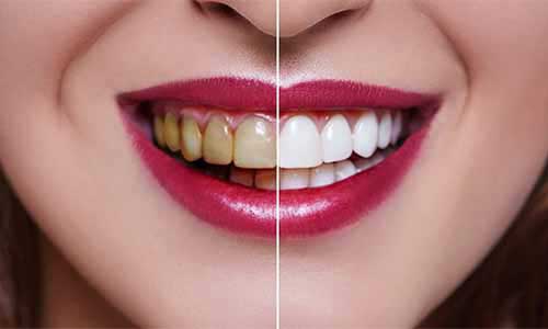 Pediatric Dental Treatment