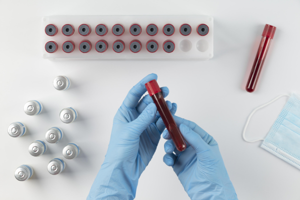 Blood Testing Services